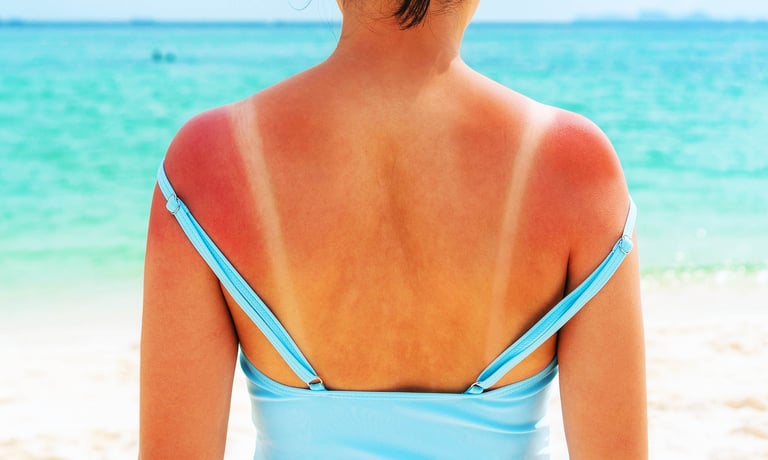 New Study Reveals RNA, Not DNA, Triggers Sunburn's Rapid Response