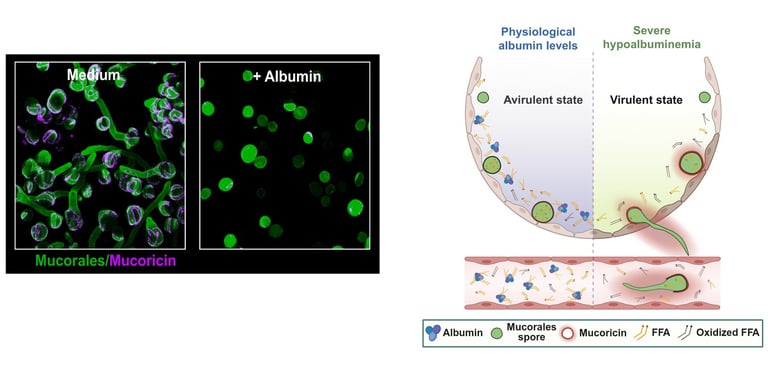 Breakthrough Study: Albumin Emerges as Key Defender Against Deadly Fungal Infection Mucormycosis