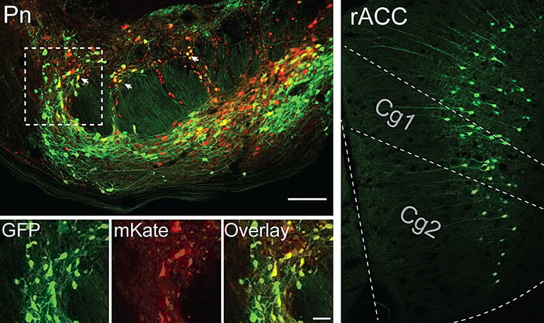 Breakthrough in Pain Relief: Scientists Uncover Brain Circuits Behind Placebo Effect