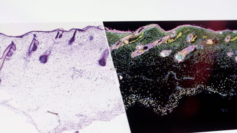 Human Cell Atlas: Mapping a Billion Cells to Revolutionize Medicine by 2026