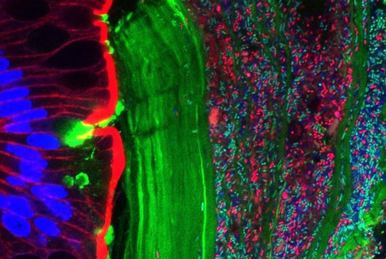 Breakthrough: Engineered Gut Bacteria Offers New Hope for Kidney Stone Prevention