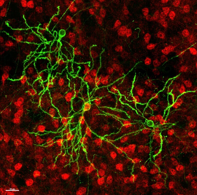 UCLA Researchers Map Mouse Neuron Morphology, Unveil Dendritic Atlas with Aging and Disease Insights