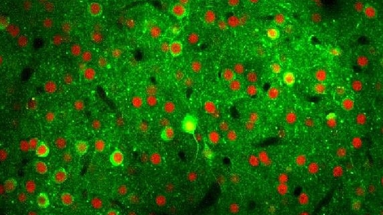 Breakthrough Study Uncovers Brain's Resilience to Neuron Loss, Paving New Paths for Alzheimer's Research