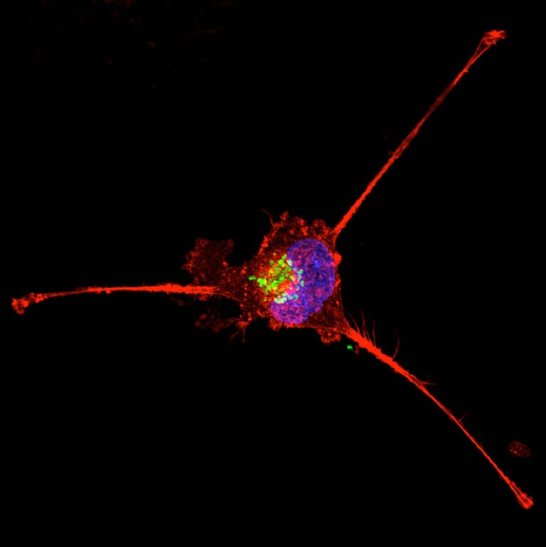 Breakthrough Study Links Breast Cancer Cell Programs and Macrophage Subtypes to Chemotherapy Response