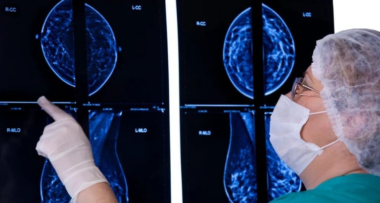 NHS Approves Capivasertib: Breakthrough Breast Cancer Drug Offers Hope to Thousands