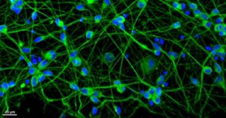 $13M Grant Fuels Innovative RNA Pollution Research to Combat Neurodegenerative Diseases