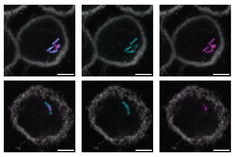 MIT Unveils Breakthrough TB Diagnostic Method Targeting ManLAM Glycan