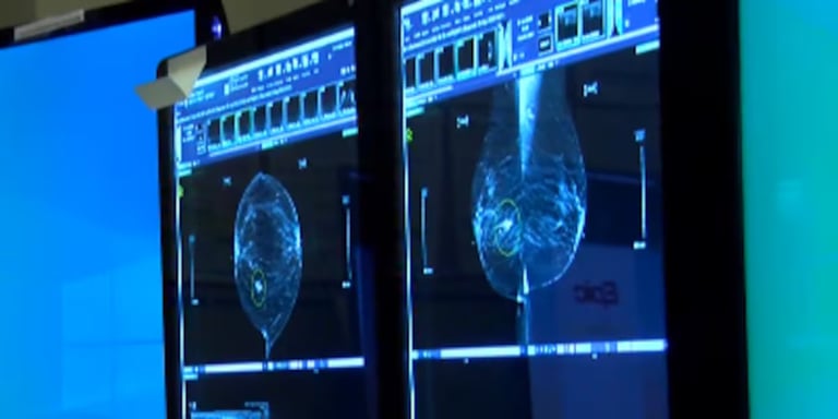 UVA's Dr. Sheybani Wins $5.5M Grant to Revolutionize Breast Cancer Treatment with Sound Waves