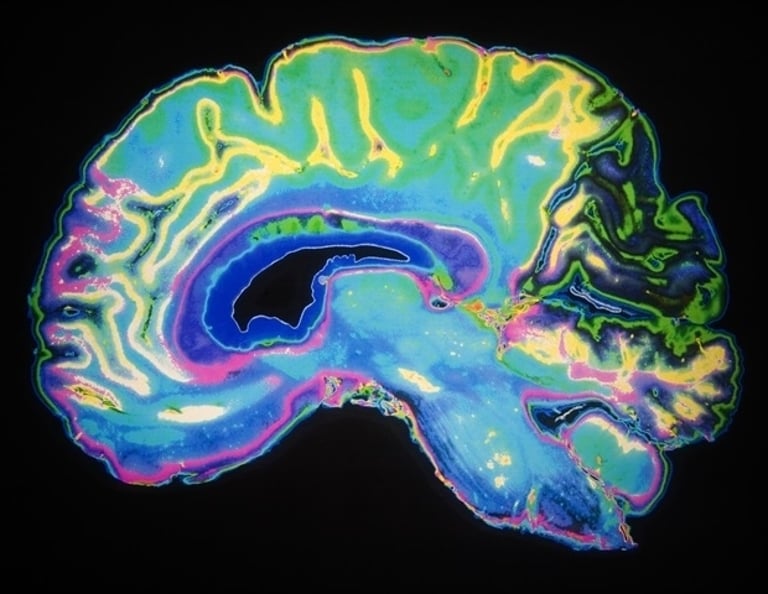 Chan Zuckerberg Initiative Launches New Biohub to Revolutionize Biological Imaging