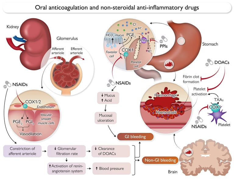 Study Warns: NSAIDs Double Bleeding Risk for Blood Thinner Users