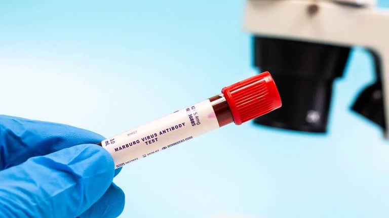 Marburg Virus Outbreak Hits Southern Ethiopia: WHO Dispatches Expert Team for Urgent Response