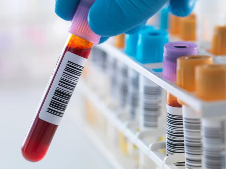 New Blood Test Could Predict Alzheimer's Risk but Faces Ethical and Practical Challenges