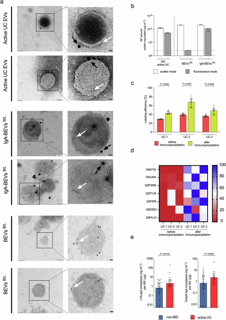 Breakthrough Study Links IgA-Coated Bacterial Vesicles to Ulcerative Colitis Inflammation