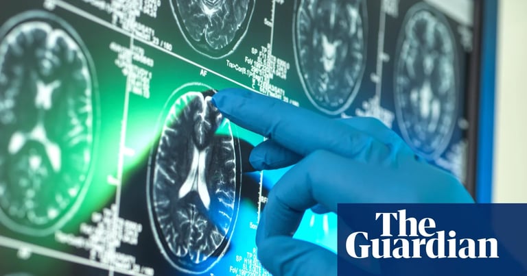 NIH Cancels $15M Grants on Racism's Impact on Brain Health, Sparking Scientific and Legal Backlash