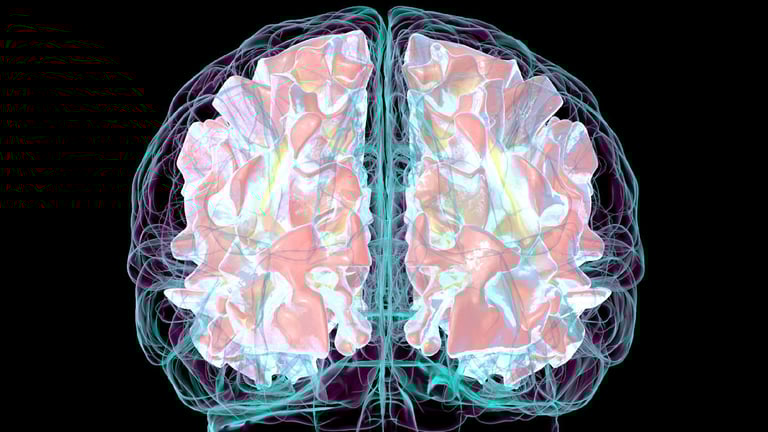 Speed-Training May Slash Dementia Risk by 25%, Study Suggests