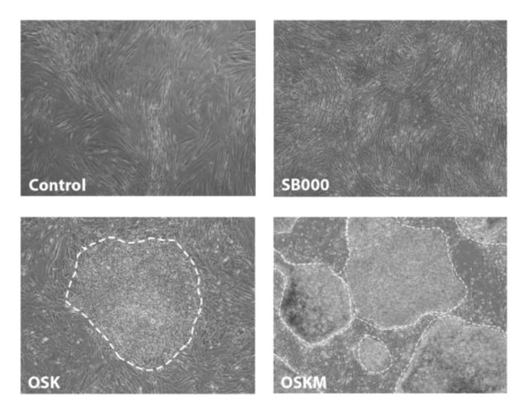Breakthrough in Aging: SB000 Gene Reverses Cellular Aging Safely, Rivals Yamanaka Factors
