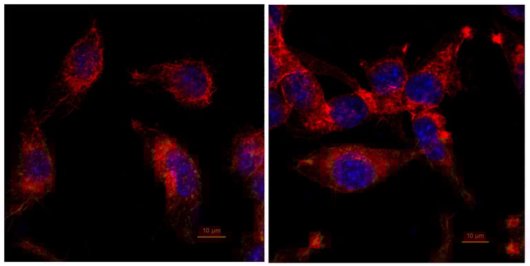 Breakthrough: Combining Rapamycin with Immunotherapy May Overcome Tumor Resistance in Immune 'Cold' Cancers