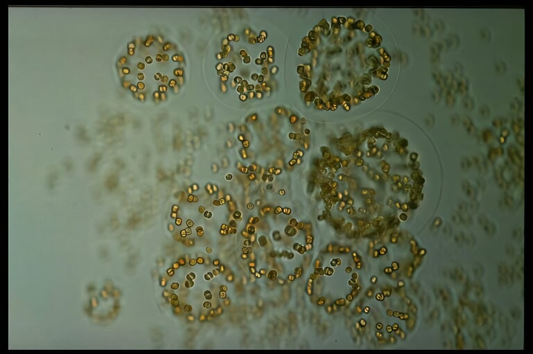 Antarctic Algal Blooms: Ancient Climate Champions at Risk from Modern Sea Ice Loss