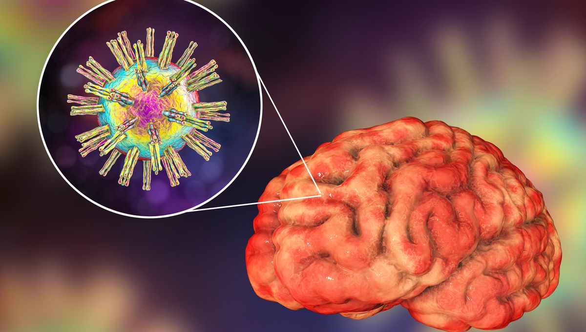 Herpes Virus Linked to Alzheimer's: New Study Reveals Pathways to Brain Invasion