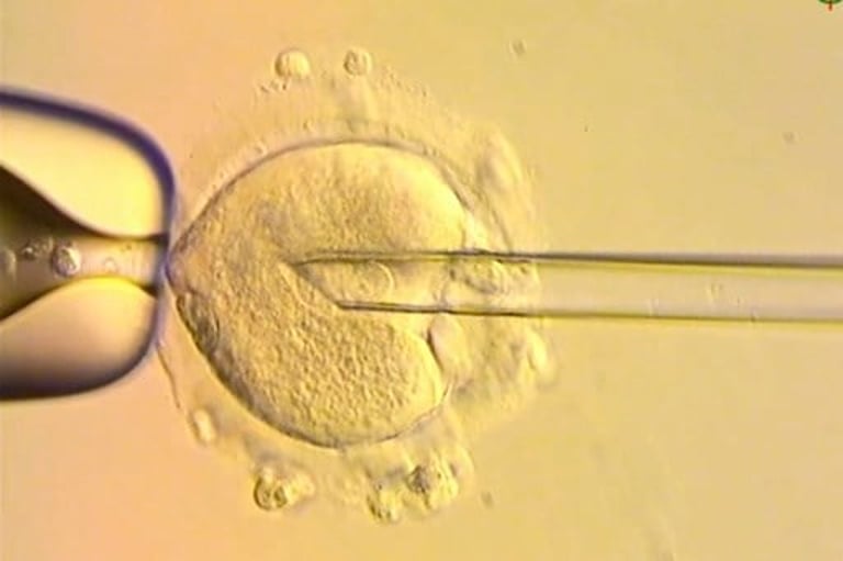 UK Welcomes First Babies Born Using Pioneering Three-Person IVF Technique