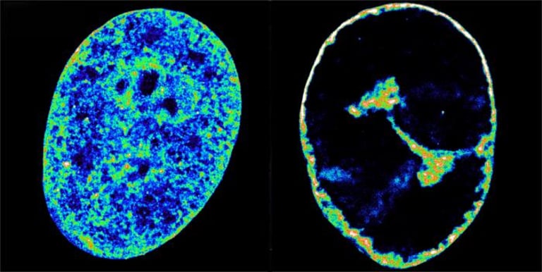 Herpes Virus Reshapes Human DNA, Opening Door for Novel Antiviral Strategies