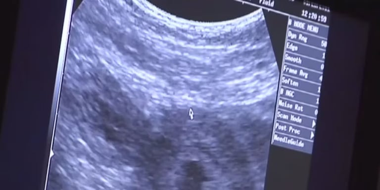 South Carolina Abortion Bill Sparks Fierce Debate Amid Push for Strictest Laws in US