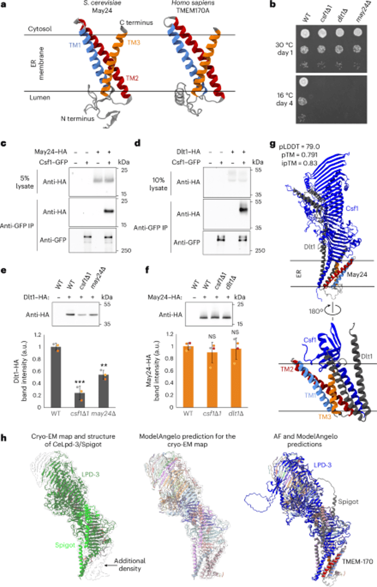 Groundbreaking Study Unveils TMEM-170's Role in Lipid Trafficking, Backed by Global Collaboration
