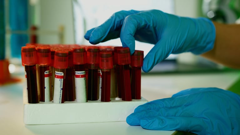 AI-Driven Blood Tests Revolutionize Spinal Injury Prognosis, Offering Cost-Effective, Early Predictions