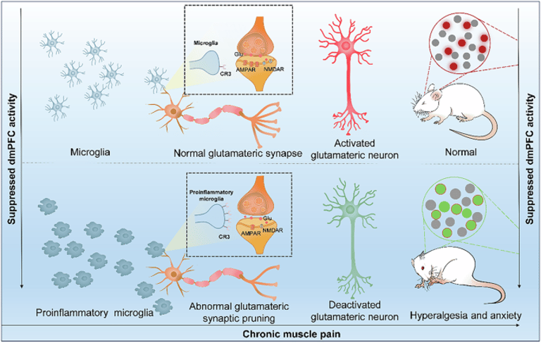 New Study Uncovers Brain's Role in Chronic Pain and Anxiety, Reveals Potential Treatment Target