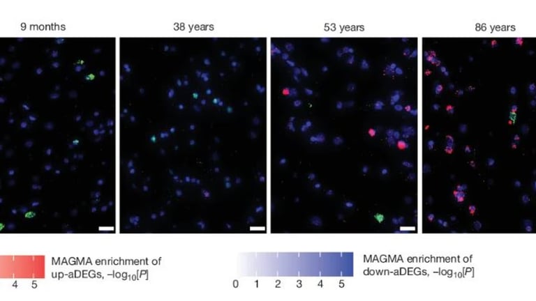 Groundbreaking Study Maps Gene Activity in Brain: Insights into Aging and Major Disorders