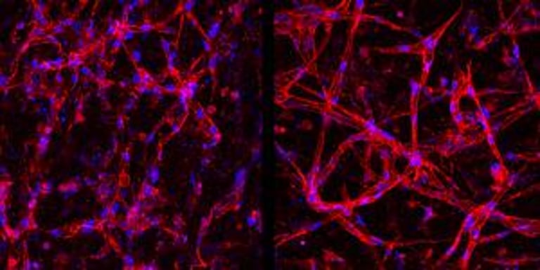 Duke Team Pioneers Stem Cell Breakthrough for Retinal Disease Therapy and Research