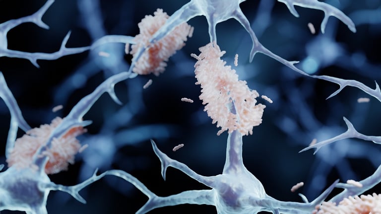 New Study Uncovers Deadly Aβ42/Fibrinogen Complex in Alzheimer's, Opening Doors for Early Intervention