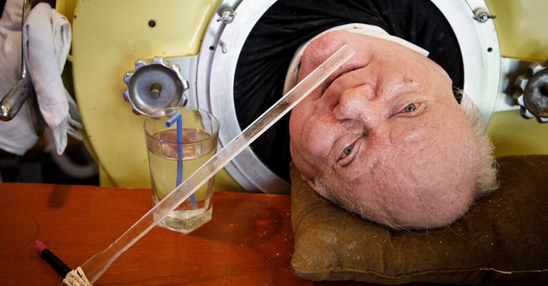Iron Lung Man, Polio Survivor and Lawyer Paul Alexander, Dies at 78