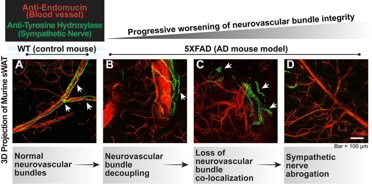 New Study Links Alzheimer's to Disrupted Fat Tissue Communication, Paving Way for Novel Treatments
