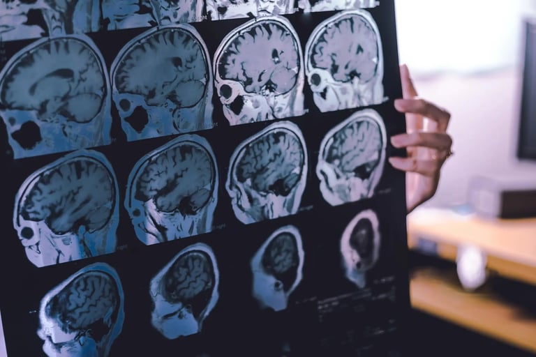 Rugby Players Face Higher Risk of Brain Injury: New Studies Spur Safety Measures