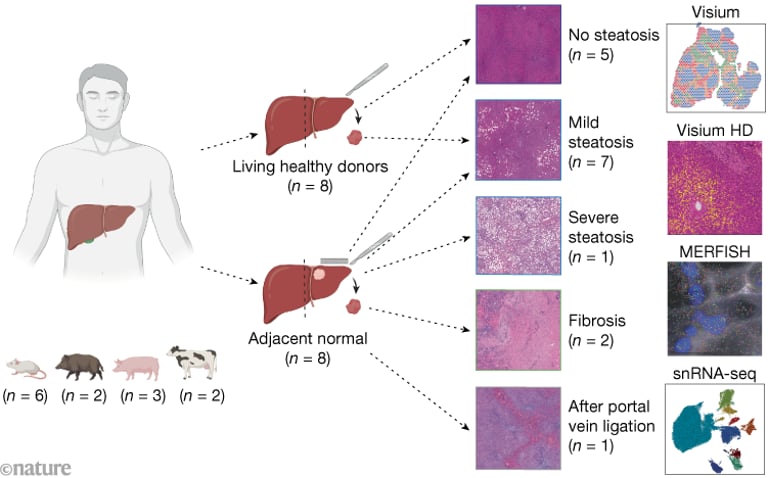 Groundbreaking Atlas Maps Human Liver Gene Expression, Reveals Unique Zonation Patterns and Disease Insights