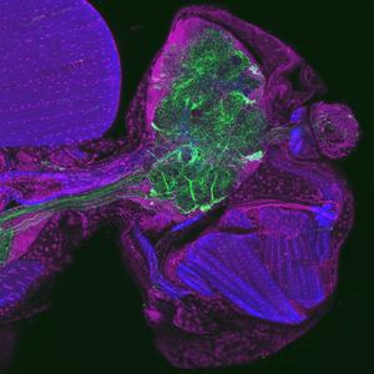 Fruit Flies Reveal Brain-Fat Axis Linking Pathogen Detection to Avoidance Behavior