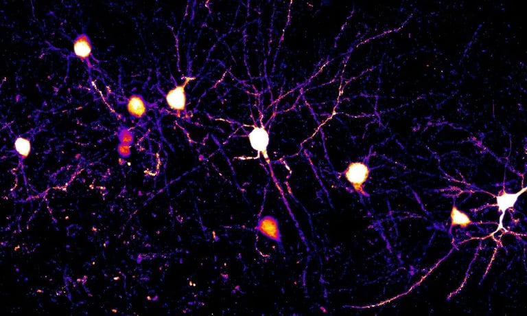 Revolutionary Study Reveals Neurons Use Multiple Plasticity Rules, Paving Way for AI and Brain Disorder Advances
