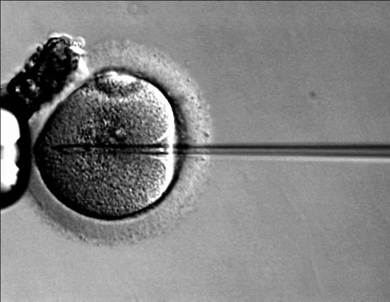 Breakthrough Gene Therapy Shows Promising Hearing Restoration for OTOF-Related Deafness