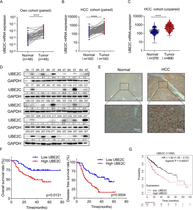 New Research Identifies UBE2C as Key Player in Liver Cancer Progression and Potential Therapeutic Target