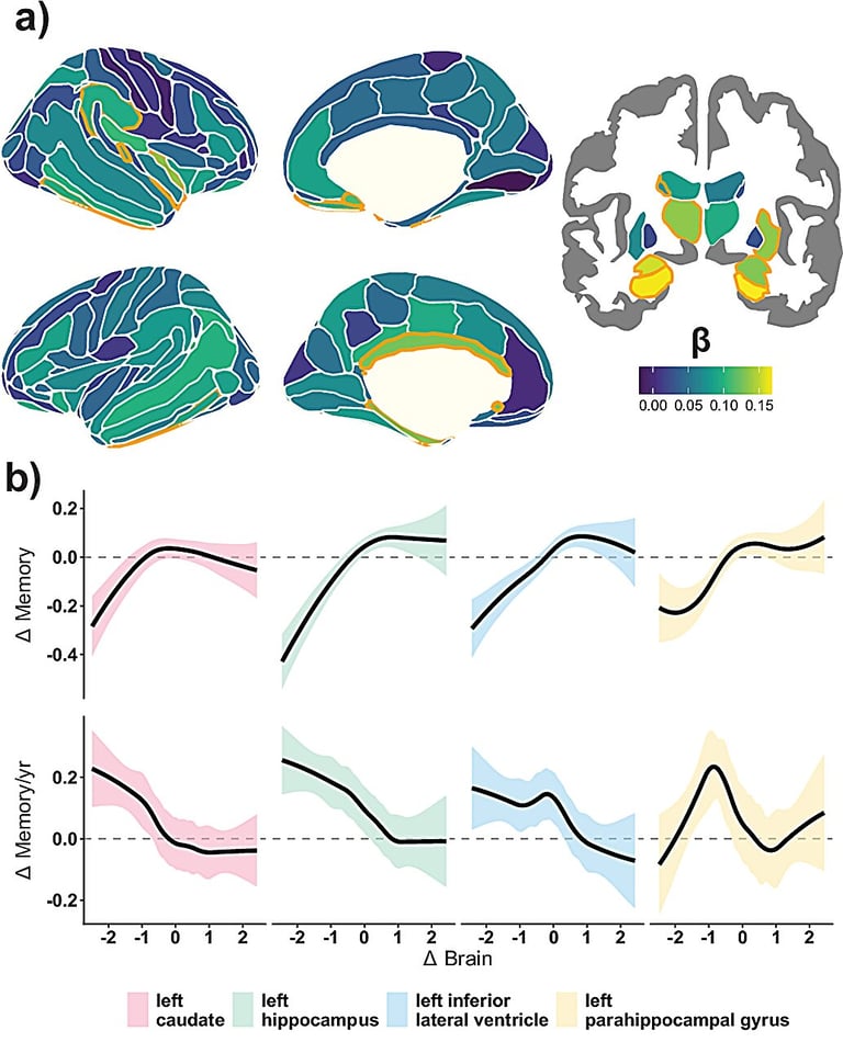 Study Reveals Memory Decline Linked to Global Brain Changes, Not Single Region