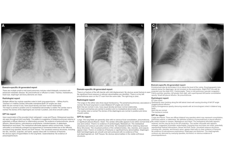 Generative AI Model Outperforms GPT-4Vision in Radiological Reporting, Achieves 95% Diagnostic Accuracy