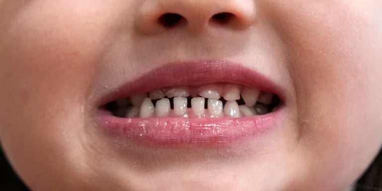 FDA Plans to Phase Out Ingestible Fluoride Amid Safety Concerns, Sparking Dental Health Debate
