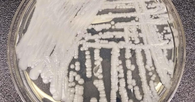 Deadly Drug-Resistant Fungus Candida Auris Spikes in U.S. Hospitals, CDC Warns