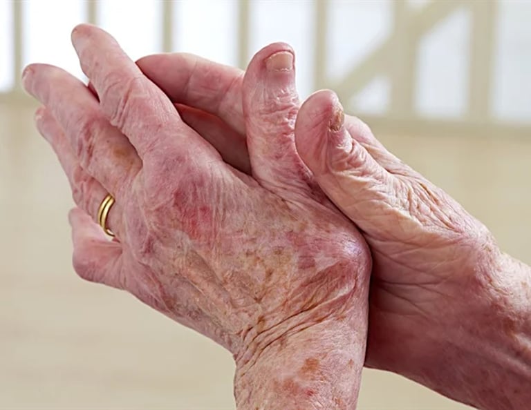 Study: JAK Inhibitors May Enhance Viral Spread, Raising Concerns for Patients with Infections