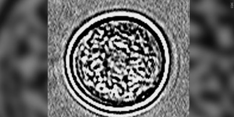 Rare Brain-Eating Amoeba Case Sparks Caution in South Carolina After Lake Murray Exposure
