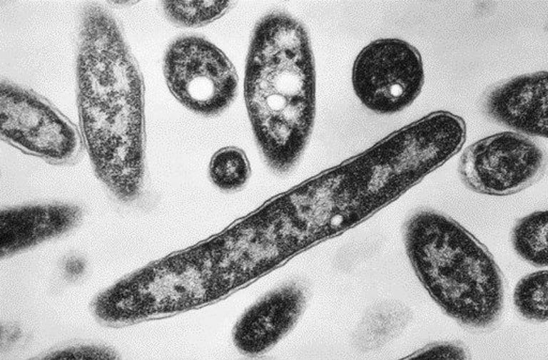 NYC Legionnaires' Outbreak Linked to Cooling Towers Claims 4 Lives; Calls for Stricter Regulations