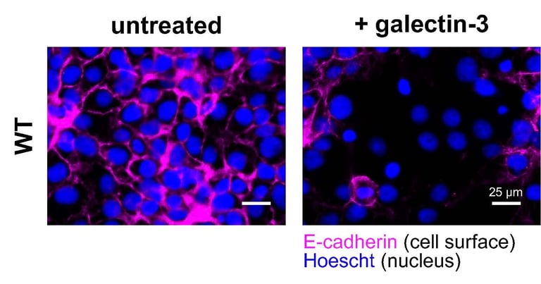 Breakthrough Study Reveals Key Role of Galectin-3 in Placental Cell Fusion and Pregnancy Health