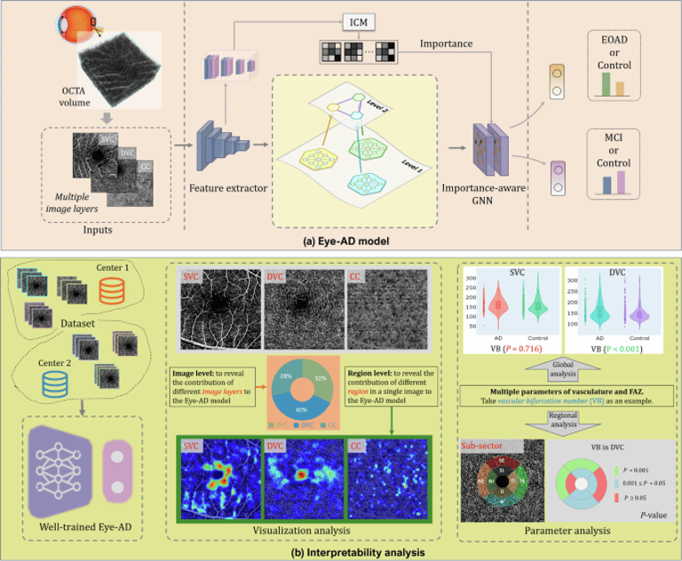 Eye-AD: Breakthrough AI Model Detects Early Alzheimer's from Retinal Scans with 93.55% Accuracy