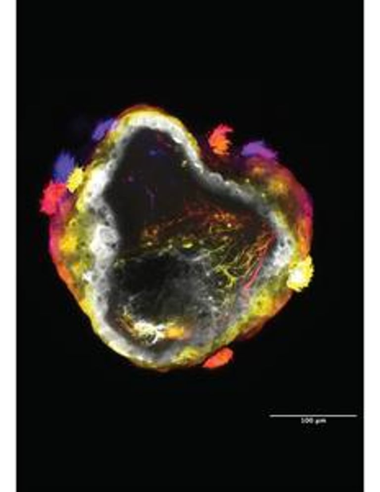 Breakthrough Study Reveals Self-Organizing Nervous Systems in 'Neurobots' with Potential Medical Applications
